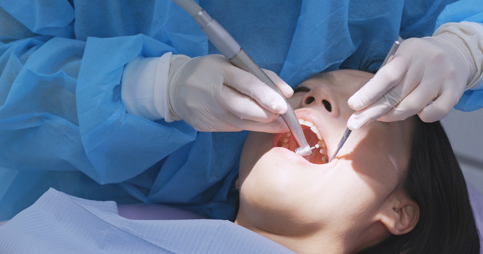 嚴重牙齦炎患者必須到牙醫診所進行洗牙，才能徹底去除牙菌膜，改善口腔健康